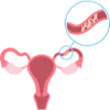 Urology