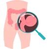 Laparoscopy